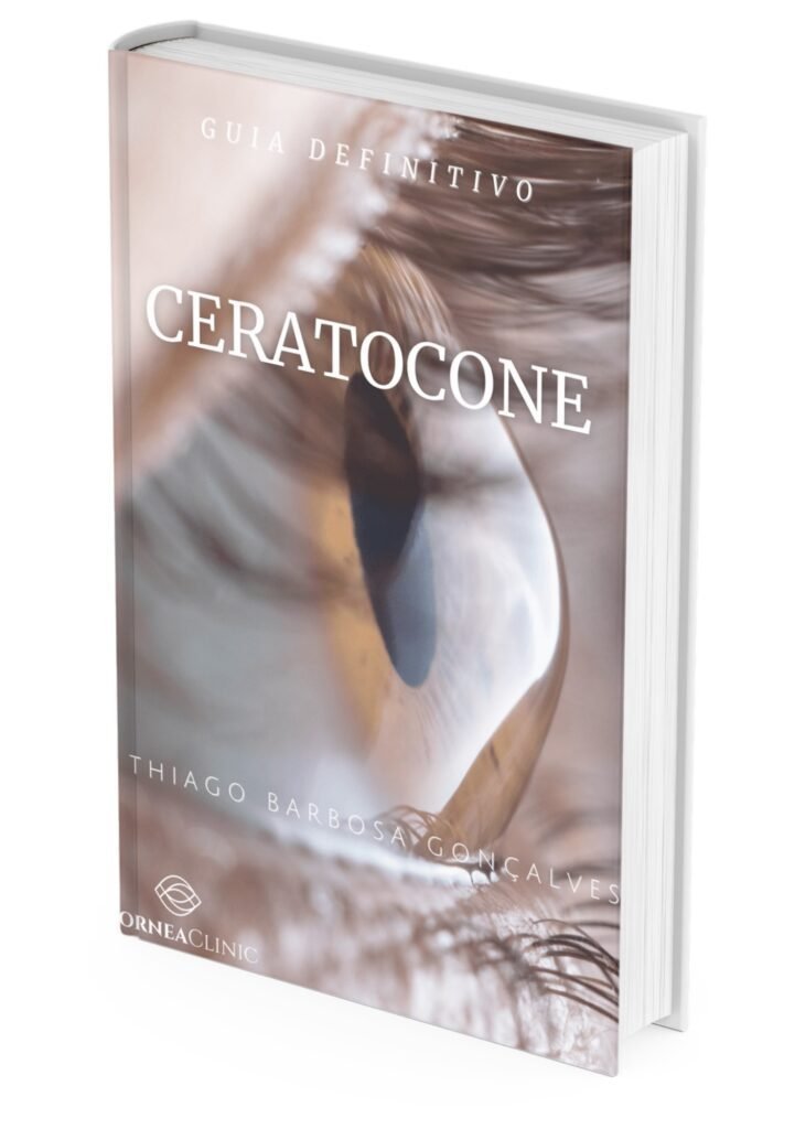 ceratocone