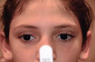 Imagem com fundo marrom e simetria.