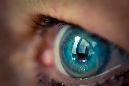 Lentes de contato